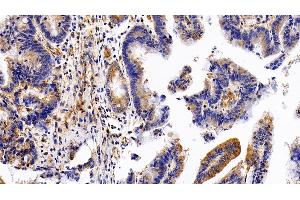 Immunohistochemistry (IHC) image for anti-Leukemia Inhibitory Factor Receptor alpha (LIFR) (AA 522-691) antibody (ABIN7437668)