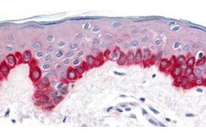 Immunohistochemistry of Apaf1 in human skin tissue with Apaf1 antibody at 20 μg/ml. (APAF1 antibody  (C-Term))