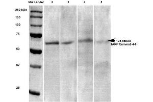 Western Blot analysis of Rat brain lysates showing detection of Stargazin Calcium Channel protein using Mouse Anti-Stargazin Calcium Channel Monoclonal Antibody, Clone S245-36 . (Stargazin antibody  (AA 203-323) (Biotin))