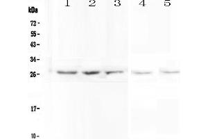 Western blot analysis of VAPB using anti-VAPB antibody . (VAPB antibody  (AA 2-55))