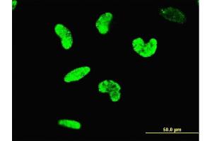 Immunofluorescence of monoclonal antibody to ARID3A on HeLa cell. (ARID3A antibody  (AA 317-416))