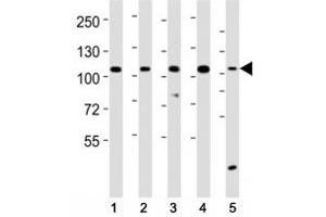 Western blot testing of LGR-5 antibody at 1:2000 dilution. (LGR5 antibody  (AA 689-719))