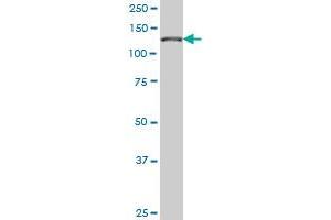 CAND1 monoclonal antibody (M02), clone 5F2 Western Blot analysis of CAND1 expression in Hela S3 NE . (CAND1 antibody  (AA 1-100))