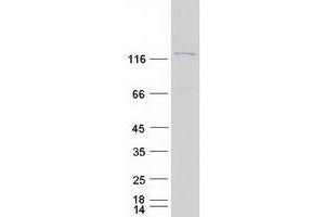 CLTCL1 Protein (Myc-DYKDDDDK Tag)