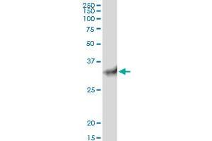 STUB1 MaxPab polyclonal antibody. (STUB1 antibody  (AA 1-303))