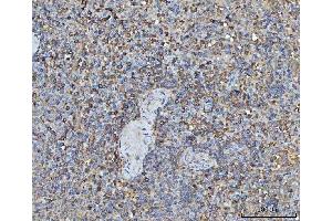 IHC analysis of TRMT61B using anti-TRMT61B antibody (ABIN7602334). (TRMT61B antibody  (AA 7-477))