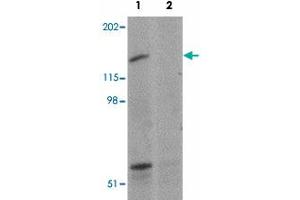 Western blot analysis of SYNPO2 in human skeletal muscle tissue lysate with SYNPO2 polyclonal antibody  at 1 ug/mL in (1) the absence and (2) the presence of blocking peptide. (SYNPO2 antibody  (N-Term))
