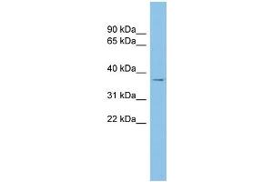WB Suggested Anti-RALY Antibody Titration: 0. (Raly antibody  (Middle Region))