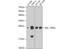 Western blot analysis of extracts of various cell lines using ASC / TMS1 Polyclonal Antibody. (PYCARD antibody)