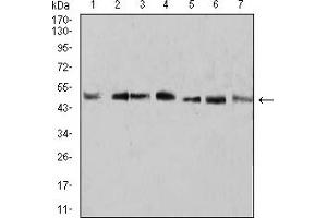 Western Blotting (WB) image for anti-Kruppel-Like Factor 2 (Lung) (KLF2) (AA 251-355) antibody (ABIN5907449)