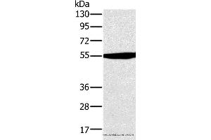 Western blot analysis of Hela cell , using OXCT1 Polyclonal Antibody at dilution of 1:300 (OXCT1 antibody)