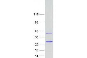 Validation with Western Blot