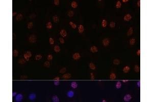 Immunofluorescence analysis of C6 cells using DiMethyl-Histone H3-K14 Polyclonal Antibody at dilution of 1:100 (40x lens). (Histone 3 antibody  (2meLys14))