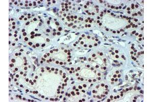 Image no. 13 for anti-Ubiquitin Specific Peptidase 7 (Herpes Virus-Associated) (USP7) antibody (ABIN1498592) (USP7 antibody)