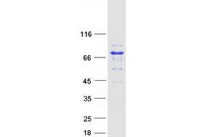 Validation with Western Blot