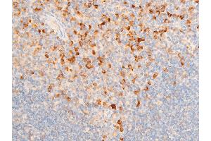 ABIN6267219 at 1/100 staining mouse spleen tissue sections by IHC-P. (NFKBIE antibody  (pSer161))