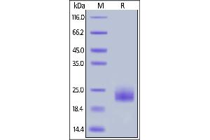 Canine GITR, His Tag on  under reducing (R) condition. (TNFRSF18 Protein (AA 23-154) (His tag))