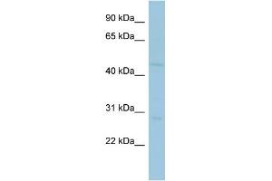 WB Suggested Anti-MAGEA10 Antibody Titration:  0. (MAGEA10 antibody  (Middle Region))