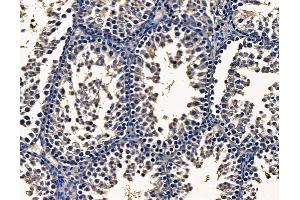 ABIN7095163 and ABIN7099219 at 1/100 staining mouse testis tissue by IHC-P.