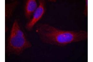 Immunofluorescence staining of methanol-fixed Hela cells using c-Cbl(phospho-Tyr700) Antibody. (CBL antibody  (pTyr770))