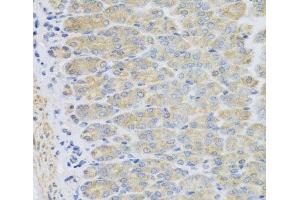 Immunohistochemistry of paraffin-embedded Mouse stomach using EFHC1 Polyclonal Antibody at dilution of 1:100 (40x lens). (EFHC1 antibody)