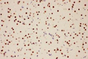 Immunohistochemistry (IHC) image for anti-Protein Inhibitor of Activated STAT, 1 (PIAS1) (AA 636-651), (C-Term) antibody (ABIN3044474)