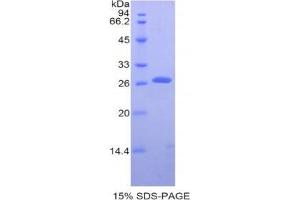 SDS-PAGE analysis of Human Transferrin Receptor Protein. (Transferrin Receptor Protein)