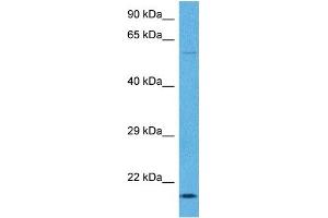 Host:  Rabbit  Target Name:  TNNI1  Sample Tissue:  Human Ovary Tumor  Antibody Dilution:  1ug/ml (TNNI1 antibody  (N-Term))