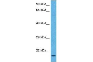 Host:  Rabbit  Target Name:  TNNI1  Sample Tissue:  Human Ovary Tumor  Antibody Dilution:  1ug/ml (TNNI1 antibody  (N-Term))