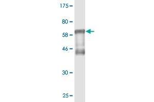Western Blot detection against Immunogen (58. (RCN1 antibody  (AA 31-331))