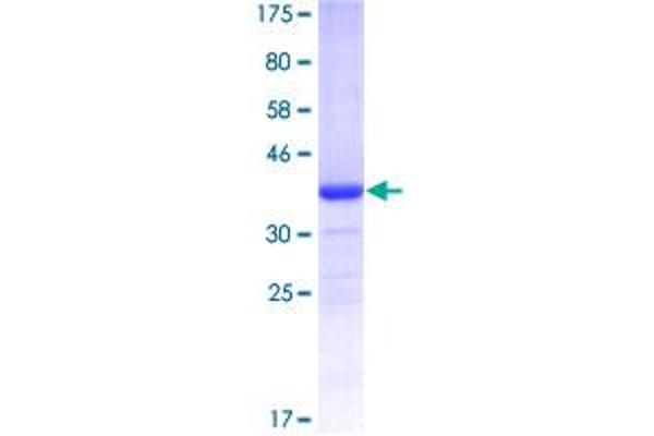 EWSR1 Protein (AA 358-453) (GST tag)