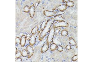 Immunohistochemistry (IHC) image for anti-Lactotransferrin (LTF) (AA 500-710) antibody (ABIN6143382)