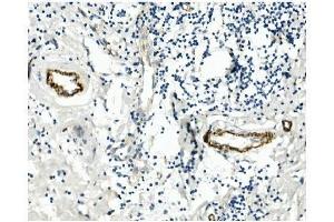 IHC analysis of CD146/MCAM using anti-CD146/MCAM antibody (ABIN7602098). (MCAM antibody  (AA 59-401))