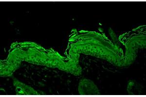 Immunohistochemistry analysis using Rabbit Anti-HSP90 Polyclonal Antibody . (HSP90 antibody  (PE))