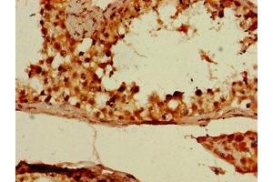 Immunohistochemistry of paraffin-embedded human testis tissue using ABIN7149640 at dilution of 1:100 (DAZL antibody  (AA 130-250))