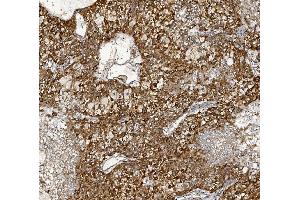 IHC analysis of MTTP using anti-MTTP antibody (ABIN7601145). (MTTP antibody  (AA 29-702))