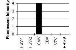 Cross Reactivity Results determined by IFA (CMV p65 antibody)