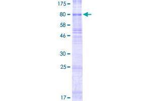 Image no. 1 for Solute Carrier Family 22 (Organic Cation Transporter), Member 11 (SLC22A11) (AA 1-550) protein (GST tag) (ABIN1320191) (SLC22A11 Protein (AA 1-550) (GST tag))