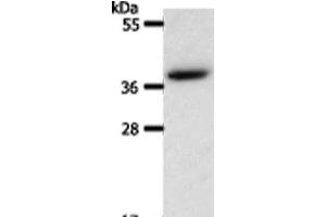 Western Blot analysis of Hela cell using AKR1B1 Polyclonal Antibody at dilution of 1:550 (AKR1B1 antibody)