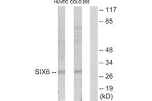 Western blot analysis of extracts from HuvEc/COLO205 cells, using SIX6 Antibody. (SIX Homeobox 6 antibody  (AA 121-170))