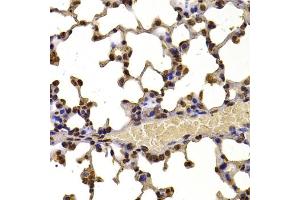 Immunohistochemistry of paraffin-embedded mouse lung using WHSC1 antibody (ABIN6128925, ABIN6150213, ABIN6150214 and ABIN6223939) at dilution of 1:100 (40x lens).