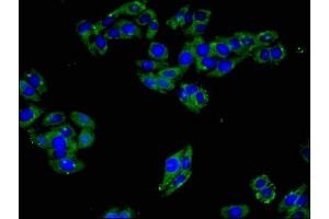Immunofluorescent analysis of HepG2 cells using ABIN7151350 at dilution of 1:100 and Alexa Fluor 488-congugated AffiniPure Goat Anti-Rabbit IgG(H+L) (ART3 antibody  (AA 279-352))