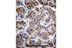 RPL15 Antibody (N-term) immunohistochemistry analysis in formalin fixed and paraffin embedded human pancreas tissue followed by peroxidase conjugation of the secondary antibody and DAB staining. (RPL15 antibody  (N-Term))