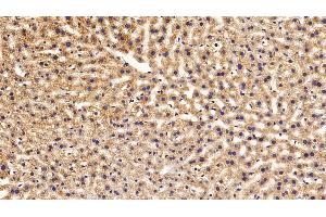 Immunohistochemistry (IHC) image for anti-Apolipoprotein C-I (APOC1) (AA 31-83) antibody (ABIN7431446)