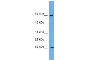 WB Suggested Anti-C20orf144 Antibody Titration: 0. (C20orf144 antibody  (Middle Region))