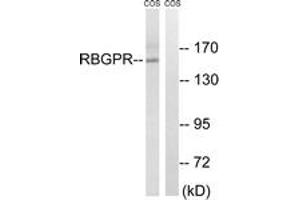 Western blot analysis of extracts from COS cells, using RAB3GAP2 Antibody. (RAB3GAP2 antibody  (AA 417-466))