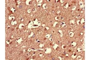 Immunohistochemistry of paraffin-embedded human brain tissue using ABIN7164558 at dilution of 1:100 (LMBRD1 antibody  (AA 6-100))