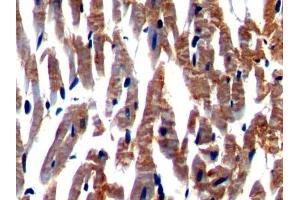 Detection of NEXN in Rat Cardiac Muscle Tissue using Polyclonal Antibody to Nexilin (NEXN) (NEXN antibody  (AA 214-455))