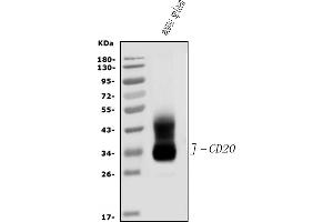 Western blot analysis of CD20/MS4A1 using anti-CD20/MS4A1 antibody (ABIN7599223). (CD20 antibody  (AA 1-291))
