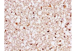 IHC image of ABIN7142091 diluted at 1:400 and staining in paraffin-embedded human brain tissue performed on a Leica BondTM system. (14-3-3 eta antibody  (AA 4-246))